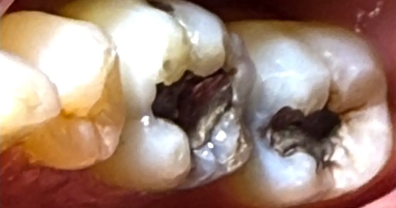 Before treatment