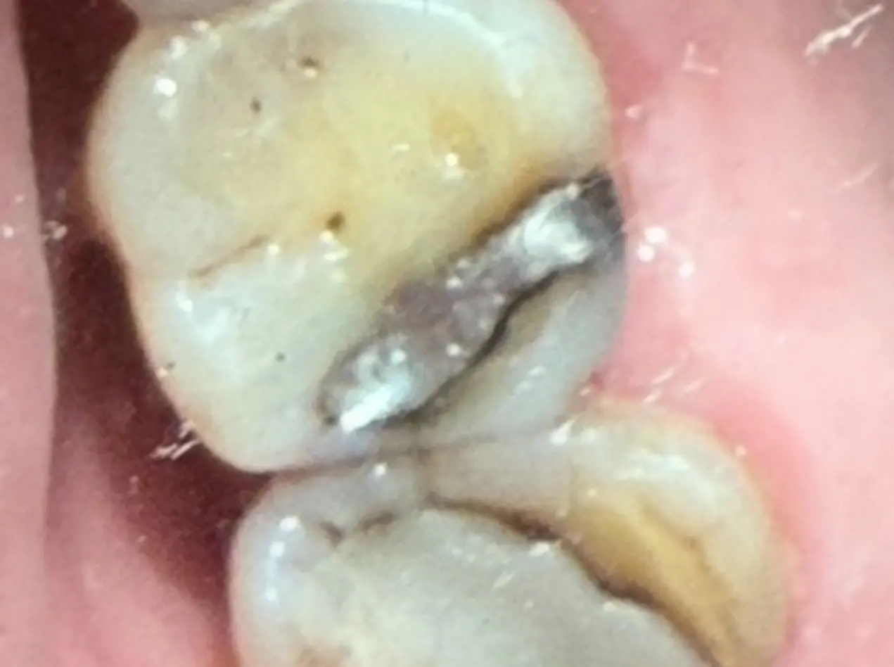 Before treatment