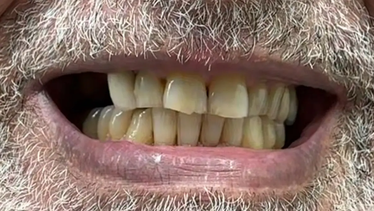 Before treatment
