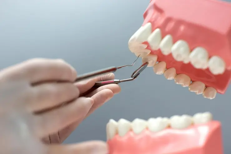 Dental Crowns and Bridges Rochester Hills, MI
