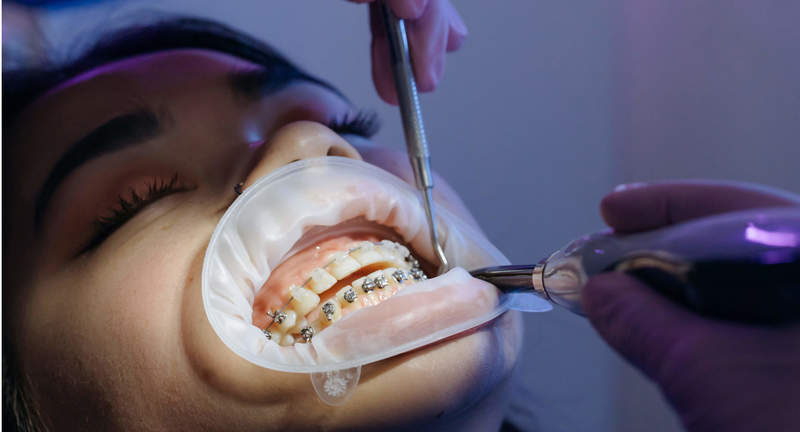 Sedation Dentistry Rochester Hills Mi Family Dentistry
