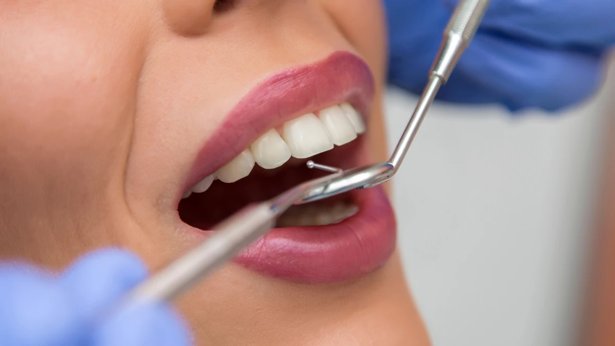 Dental Bonding Hackensack NJ