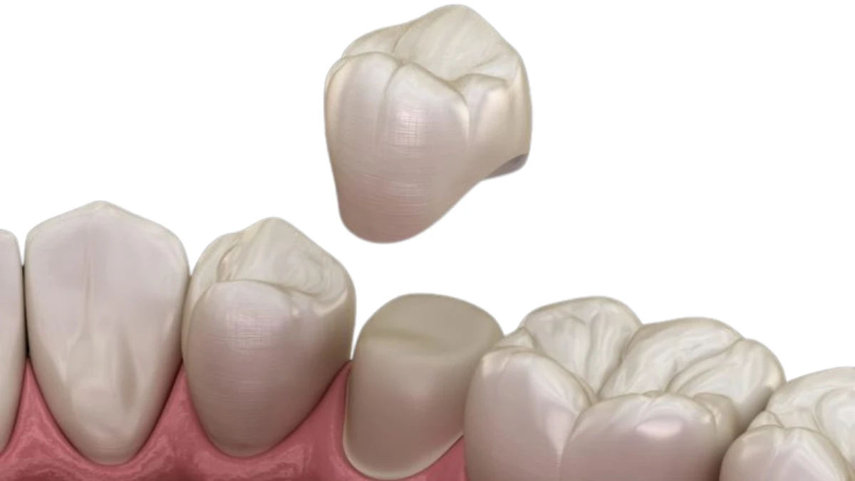 Dental Crowns Hackensack